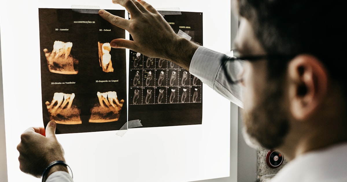 Faceta de Porcelana vs Resina: Diferenças e Qual Escolher